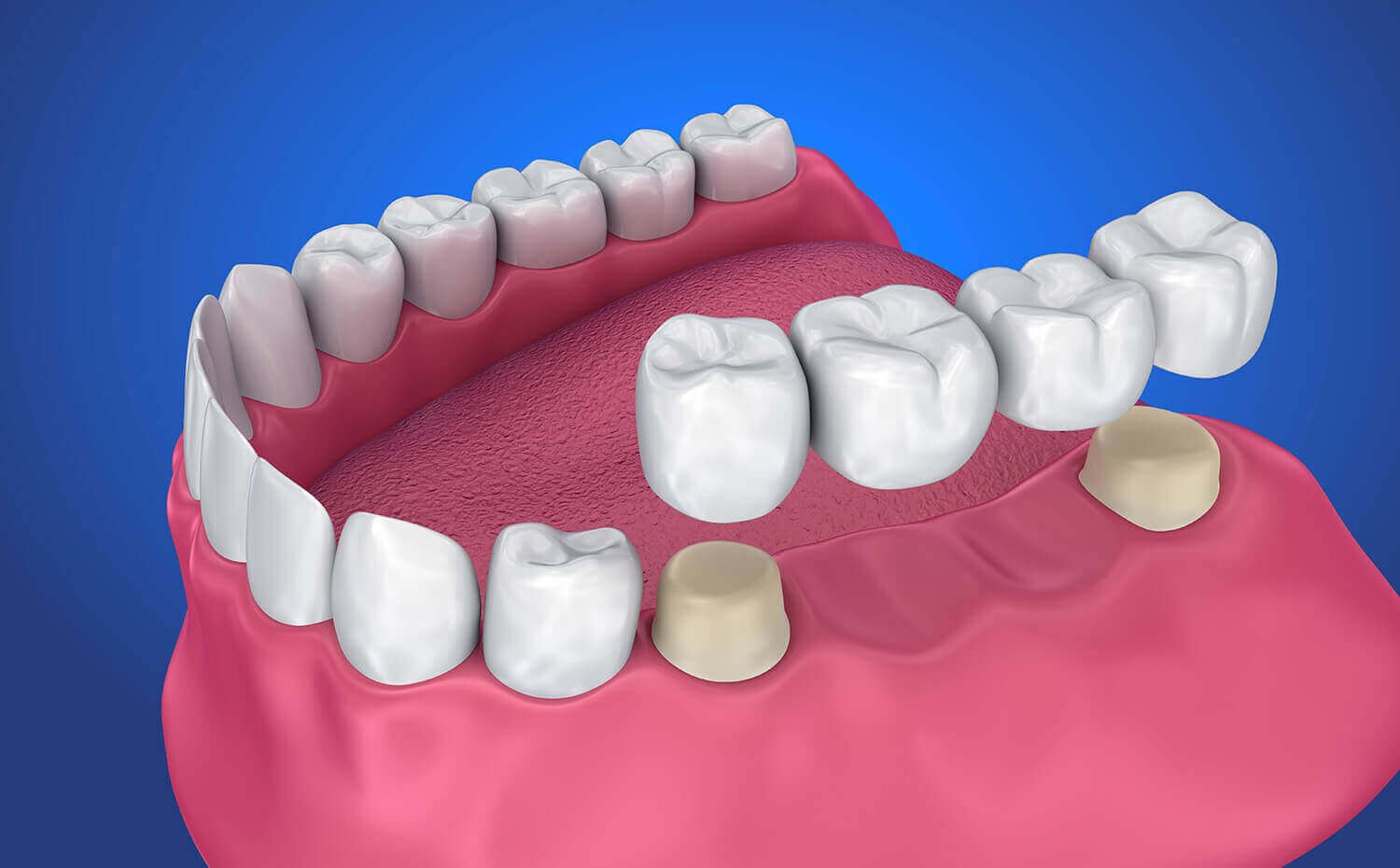 Oral Cancer Screening