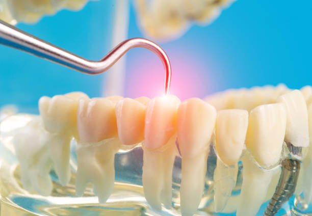 Dental Trauma