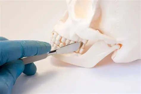 Wisdom Tooth / Impacted Tooth Removal