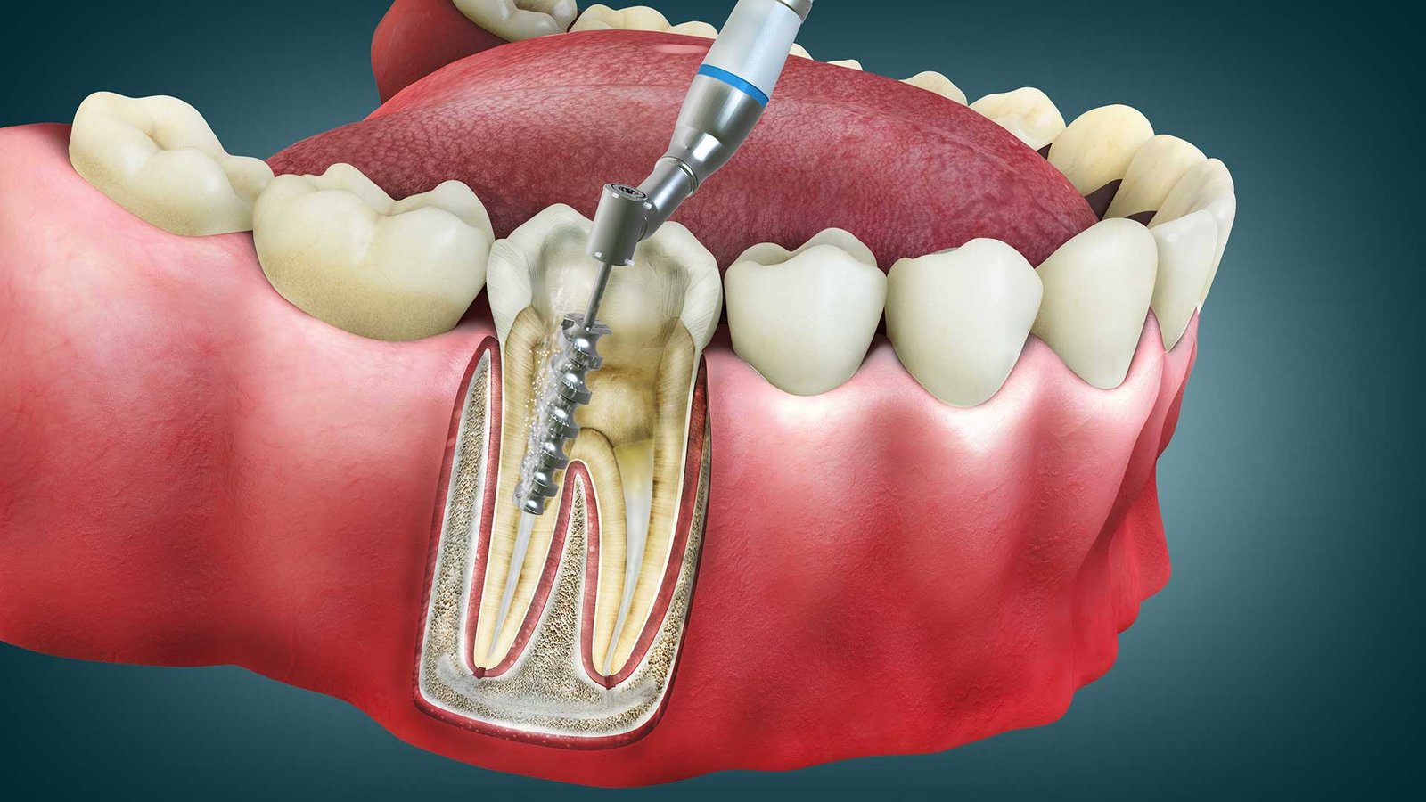Single-Visit RCT